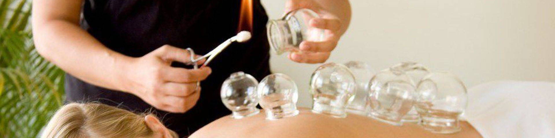 Cupping therapie chen